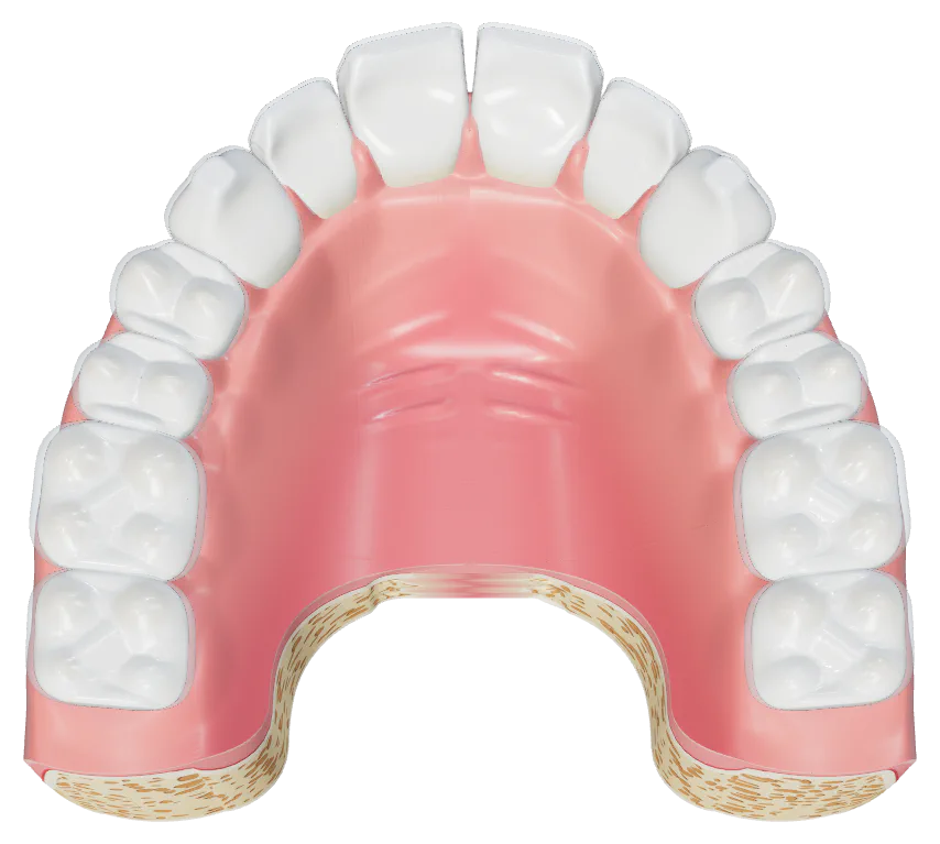 Illustration, viewed from below: the same jaw widened along its seam, with a broad, dome-shaped palate