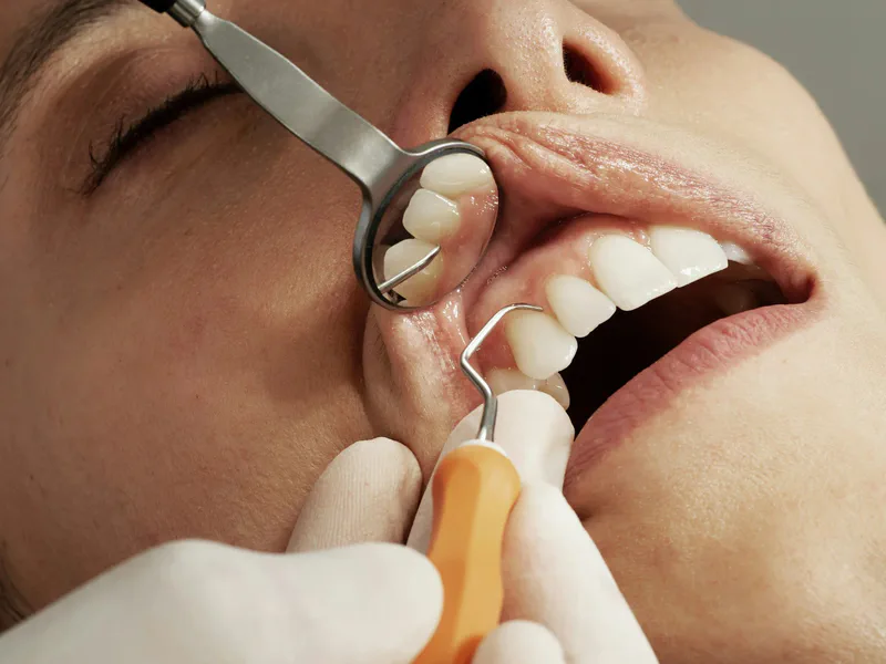 Gum Disease Treatment at Happy Tooth Kurri Kurri