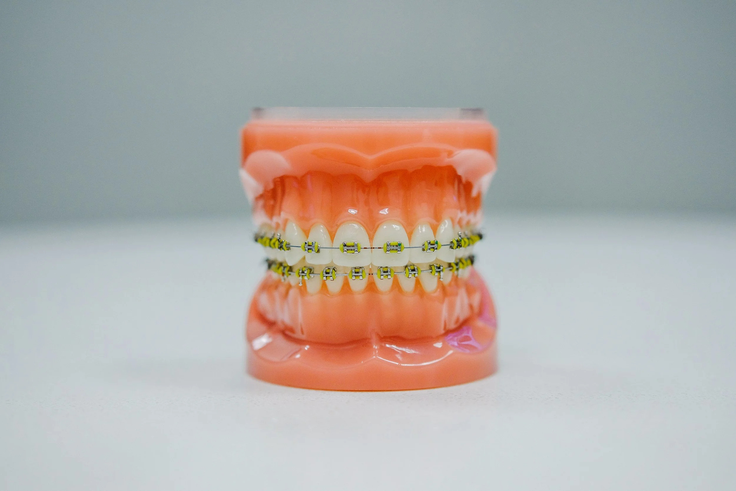 Orthodontics & Aligners at Happy Tooth Kurri Kurri