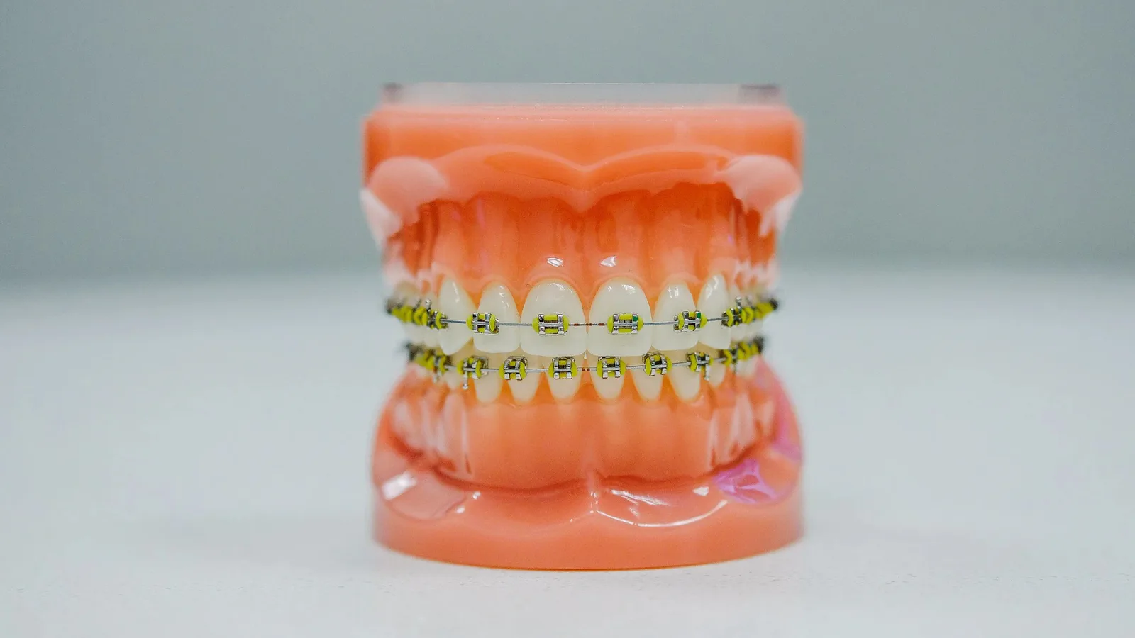 Invisalign & Orthodontics at Happy Tooth Kurri Kurri