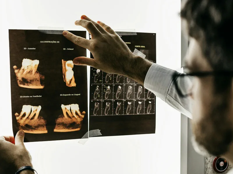 Root Canal Therapy at Happy Tooth Kurri Kurri